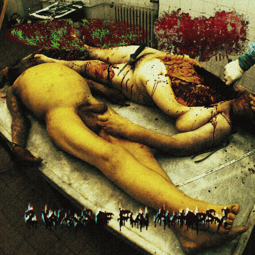 Estenosis Aortica : 2 Ways of Fun Autopsy!